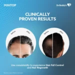 Mintop Dr. Reddy 5 % Topical Solution 60ml - Image 2