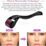 Derma roller system 1.0mm. - Image 3